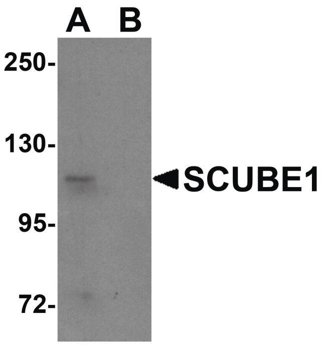 Western blot analysis of Daudi cell lysate using a SCUBE1 polyclonal antibody (Product # PA5-20990) at 1 ug/mL in either (A) the presence and (B) the absence of blocking peptide.