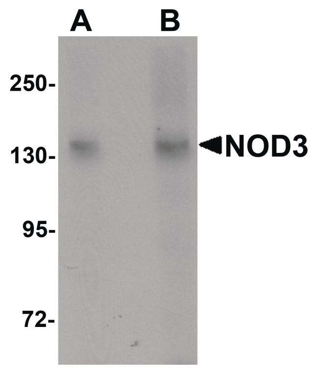 Western blot analysis of 3T3 cell lysate using a NOD3 polyclonal antibody (Product # PA5-21016) at (A) 1 and (B) 2 ug/mL.