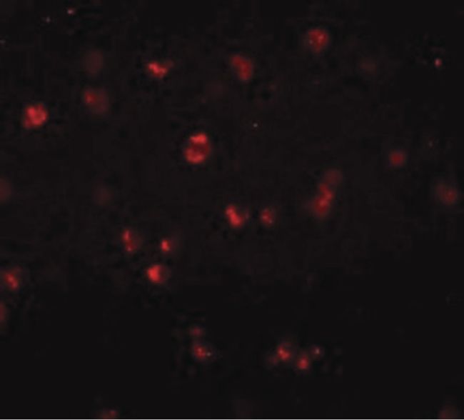 Immunofluorescent analysis of Jurkat cells using a NOD3 polyclonal antibody (Product # PA5-21016) at a 20 ug/mL dilution.