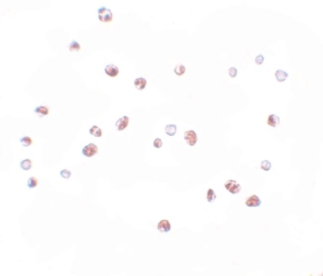 Immunocytochemistry staining of HeLa cells using a NOD4 polyclonal antibody (Product # PA5-21017) at a 10 ug/mL dilution.