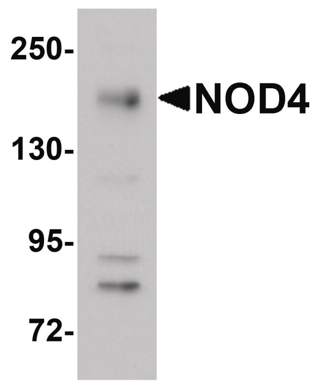 Western blot analysis of EL4 cell lysate using a NOD4 polyclonal antibody (Product # PA5-21017) at 1 ug/mL.