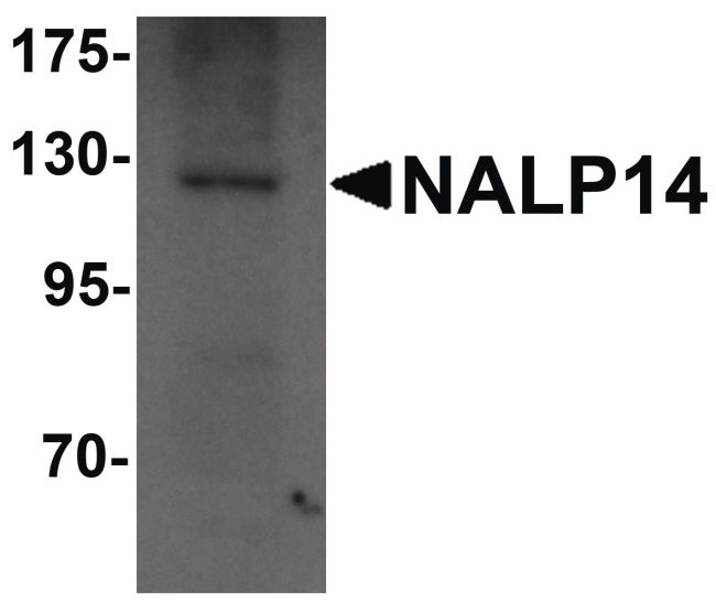 Western blot analysis of rat brain tissue lysate using a NALP14 polyclonal antibody (Product # PA5-21029) at 1 ug/mL.