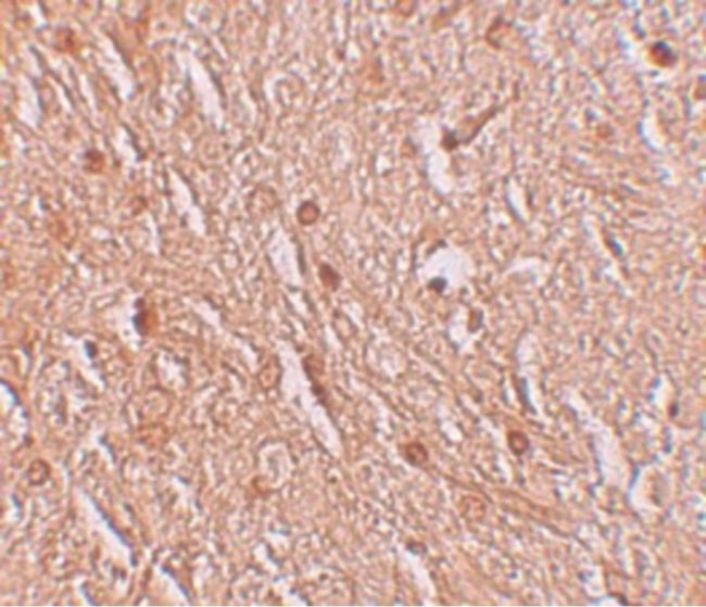 Immunohistochemical staining of human brain tissue using a LMBRD1 polyclonal antibody (Product # PA5-21061) at a 25 ug/mL dilution.