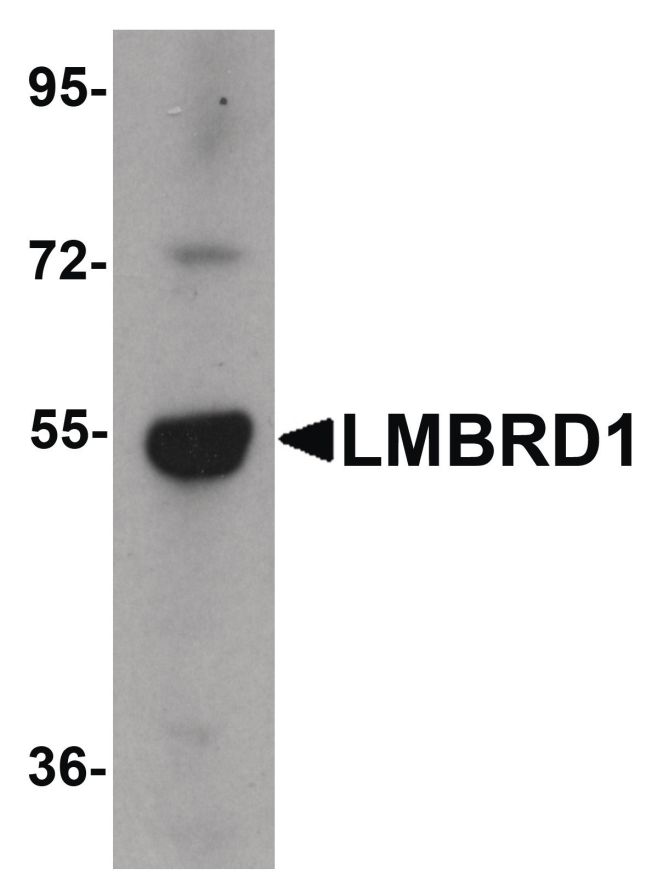 Western blot analysis of human brain tissue lysate using a LMBRD1 polyclonal antibody (Product # PA5-21061) at 1 ug/mL.