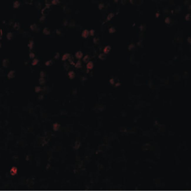 Immunofluorescent analysis of human brain tissue using a LMBRD1 polyclonal antibody (Product # PA5-21061) at a 20 ug/mL dilution.