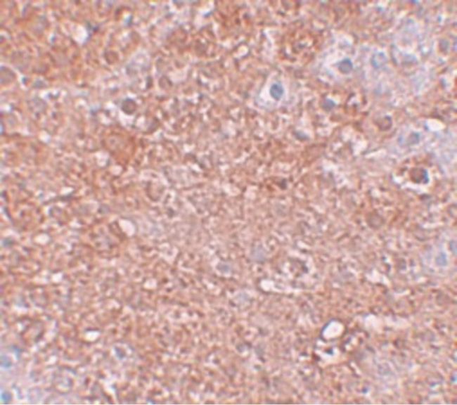 Immunohistochemical staining of mouse liver tissue using a ZIP12 polyclonal antibody (Product # PA5-21075) at a 25 ug/mL dilution.