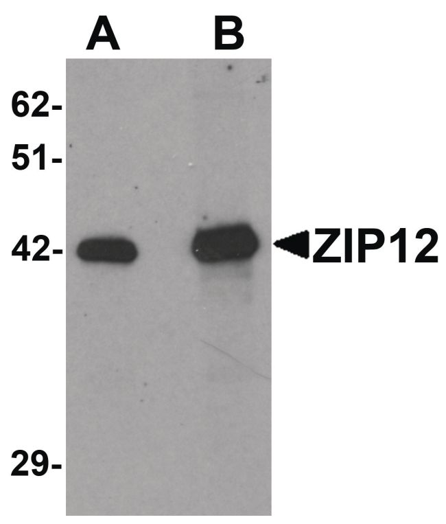 Western blot analysis of HepG2 cell lysate using a ZIP12 polyclonal antibody (Product # PA5-21075) at (A) 0.5 and (B) 1 ug/mL.