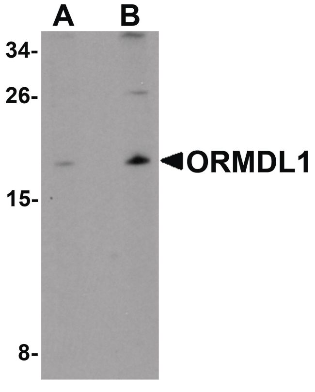 Western blot analysis of SK-N-SH Cell lysate using a ORMDL1 polyclonal antibody (Product # PA5-21146) at (A) 1 ug/mL and (B) 2 ug/mL.