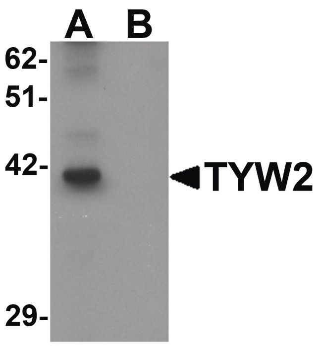 Western blot analysis of K562 cell lysate using a TYW2 polyclonal antibody (Product # PA5-21153) at 0.5 ug/mL in either (A) the presence and (B) the absence of blocking peptide.