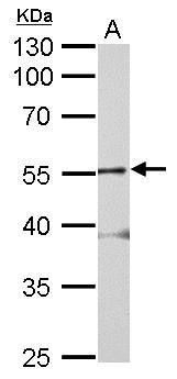 Western blot analysis of alpha 2 Glycine Receptor using 50 µg mouse brain lysate. Samples were loaded onto a 10% SDS-PAGE gel and probed with an Alpha 2 Glycine Receptor polyclonal antibody (Product # PA5-21673) at a dilution of 1:2000.