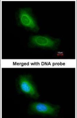 Immunofluorescent analysis of CCDC68 in paraformaldehyde-fixed HeLa cells using a CCDC68 polyclonal antibody (Product # PA5-21801) at a 1:200 dilution.