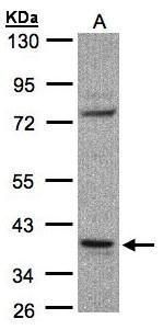 Western blot analysis of CCDC68 using 30µg of Raji lysate. Samples were loaded onto a 10% SDS-PAGE gel and probed with a CCDC68 polyclonal antibody (Product # PA5-21801) at a dilution of 1:1000.