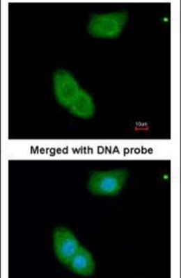 Immunofluorescent analysis of EHBP1 in paraformaldehyde-fixed A549 cells using an EHBP1 polyclonal antibody (Product # PA5-22088) at a 1:200 dilution.