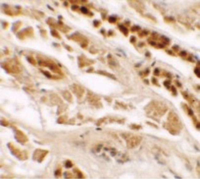 Immunohistochemical staining of human kidney tissue using a TTYH2 polyclonal antibody (Product # PA5-34395) at a 25 ug/mL dilution.