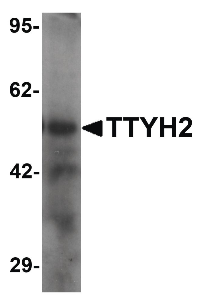 Western blot analysis of human kidney tissue lysate using a TTYH2 polyclonal antibody (Product # PA5-34395) at 1 ug/ml
