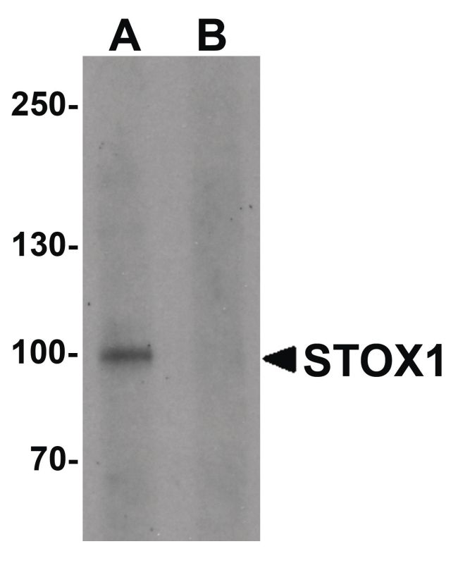 Western blot analysis of human liver tissue lysate using a STOX1 polyclonal antibody (Product # PA5-34398) at 1 ug/ml in either (A) the presence and (B) the absence of blocking peptide.