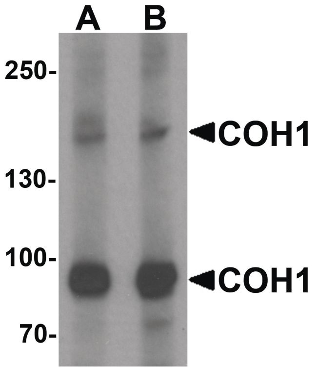 Western blot analysis of SK-N-SH cell lysate using a COH1 polyclonal antibody (Product # PA5-34406) at (A) 1 and (B) 2 ug/mL.