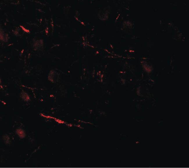 Immunofluorescent analysis of human brain tissue using a COH1 polyclonal antibody (Product # PA5-34406) at a 20 ug/mL dilution.