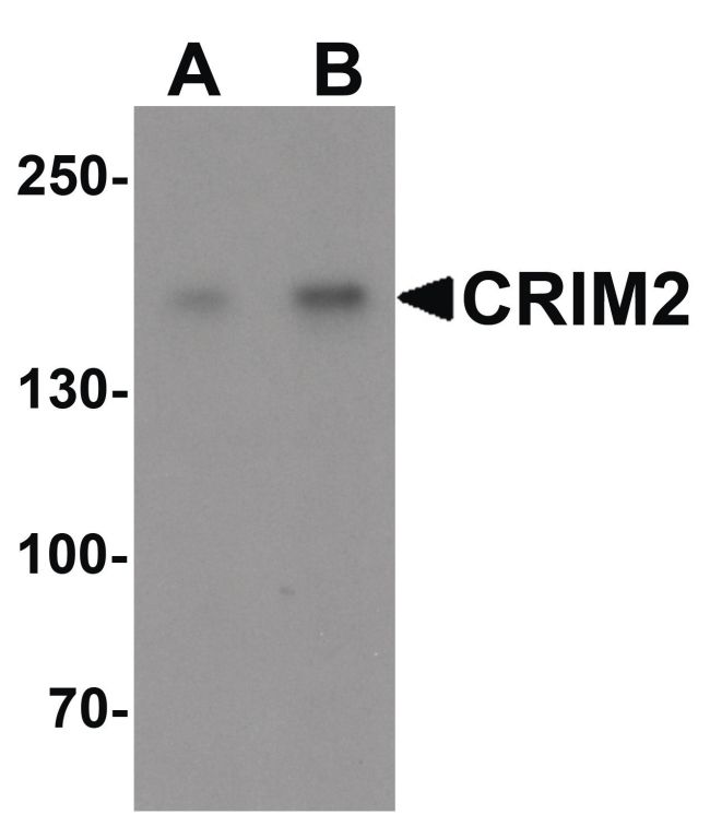 Western blot analysis of Jurkat cell lysate using a CRIM2 polyclonal antibody (Product # PA5-34411) at (A) 1 and (B) 2 ug/mL.