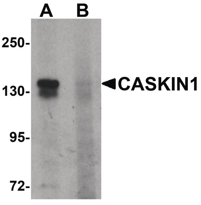 Western blot analysis of HeLa cell lysate using a CASKIN1 polyclonal antibody (Product # PA5-34424) at 1 ug/ml in either (A) the presence and (B) the absence of blocking peptide.