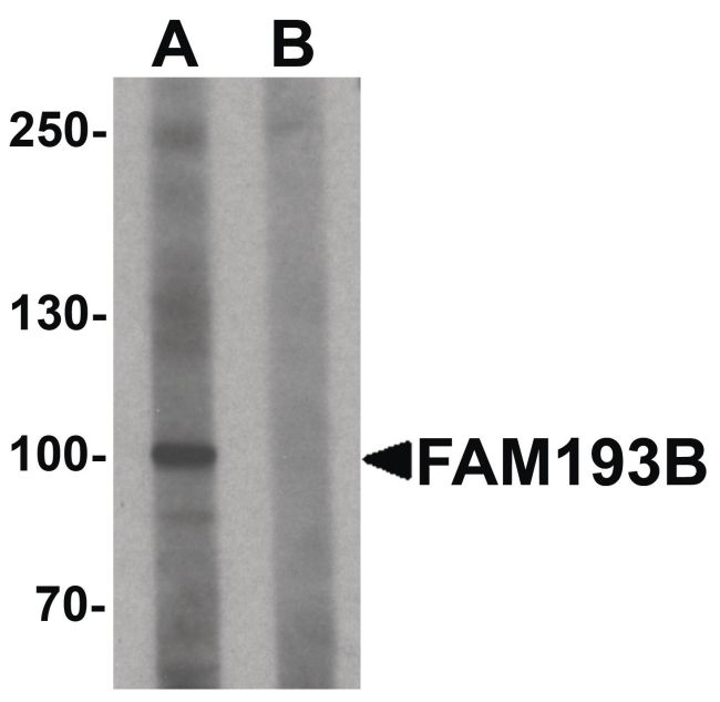Western blot analysis of Jurkat cell lysate using a FAM193B polyclonal antibody (Product # PA5-34440) at 1 ug/mL in either (A) the presence and (B) the absence of blocking peptide.
