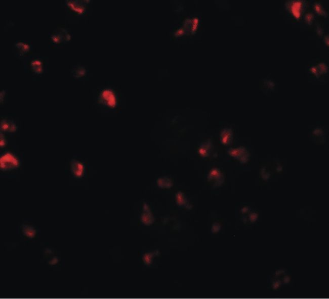 Immunofluorescent analysis of Jurkat cells using a FAM193B polyclonal antibody (Product # PA5-34440) at a 20 ug/mL dilution.