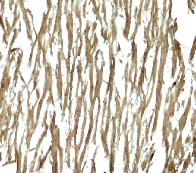 Immunohistochemistry analysis of DNAJC13 in paraffin-embedded human heart tissue using a DNAJC13 polyclonal antibody (Product # PA5-38026) at a dilution of 5ug/ml.