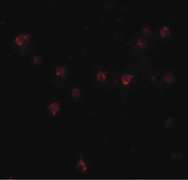 Immunofluorescent analysis of A20 cells using a DDX60 polyclonal antibody (Product # PA5-34442) at a 20 ug/mL dilution.