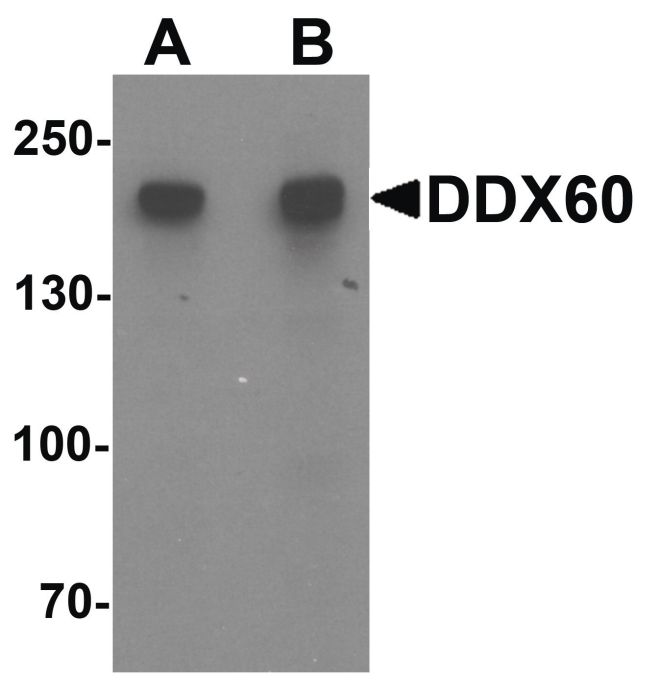 Western blot analysis of A20 cell lysate using a DDX60 polyclonal antibody (Product # PA5-34442) at (A) 1 and (B) 2 ug/mL.