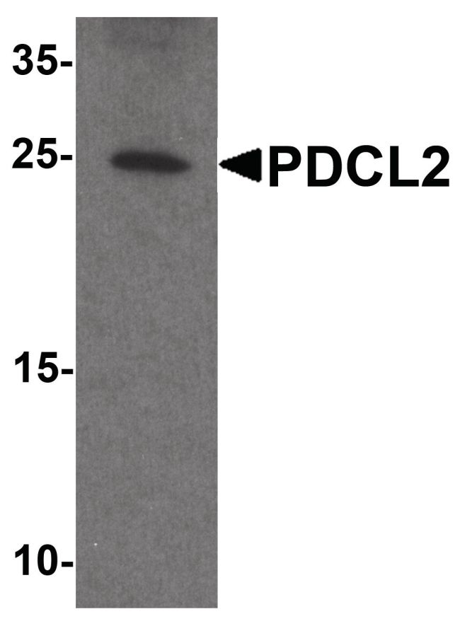 Western blot analysis of PDCL2 in rat liver tissue lysate using a PDCL2 polyclonal antibody (Product # PA5-38056) at a dilution of 1ug/ml.