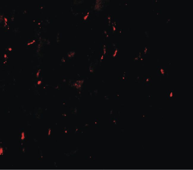 Immunofluorescent analysis of human brain using a MYT1L polyclonal antibody (Product # PA5-34468) at a 20 ug/mL dilution.