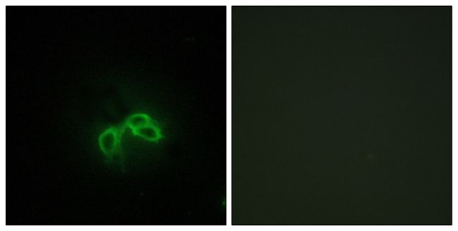 Immunofluorescent analysis of BLCAP in NIH-3T3 cells using a BLCAP polyclonal antibody (Product # PA5-38639).