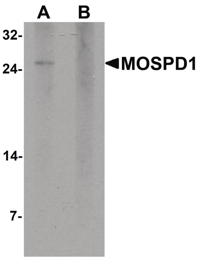 Western blot analysis of human brain tissue lysate using a MOSPD1 polyclonal antibody (Product # PA5-34529) at 1 ug/mL in either (A) the presence and (B) the absence of blocking peptide.