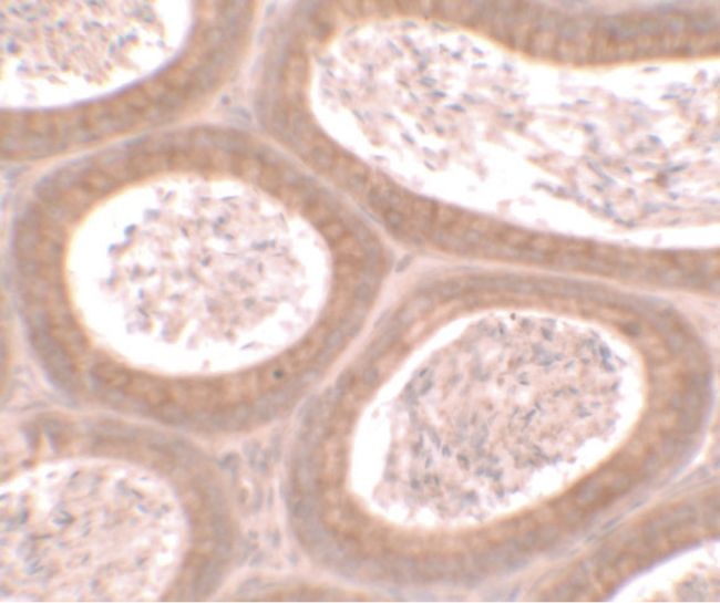Immunohistochemical staining of mouse testis tissue using a MOSPD1 polyclonal antibody (Product # PA5-34529) at a 25 ug/ml dilution.