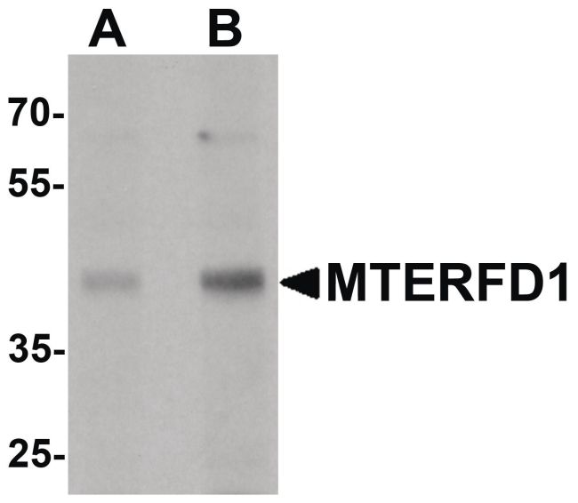Western blot analysis of 3T3 cell lysate using a MTERFD1 polyclonal antibody (Product # PA5-34530) at (A) 1 and (B) 2 ug/mL.