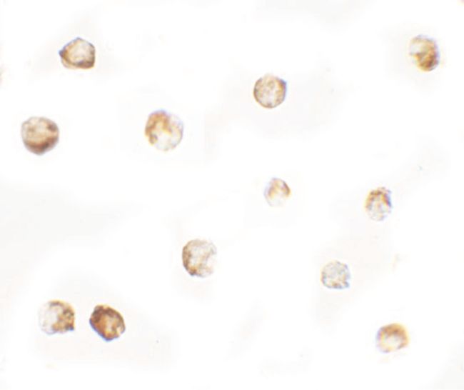 Immunocytochemistry staining of 3T3 cells using a MTERFD1 polyclonal antibody (Product # PA5-34530) at a 5 ug/mL dilution.