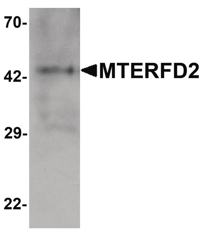 Western blot analysis of human small intestine tissue lysate using a MTERFD2 polyclonal antibody (Product # PA5-34531) at 1 ug/mL.