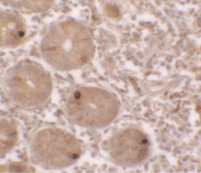 Immunohistochemical staining of human small intestine tissue using a MTERFD2 polyclonal antibody (Product # PA5-34531) at a 25 ug/ml dilution.
