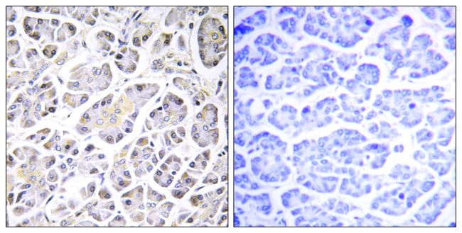Immunohistochemical analysis of ATP5G3 in paraffin-embedded human pancreas tissue using an ATP5G3 polyclonal antibody (Product # PA5-39035).