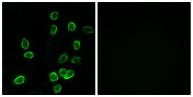 Immunofluorescent analysis of ATP5G3 in A549 cells using an ATP5G3 polyclonal antibody (Product # PA5-39035).