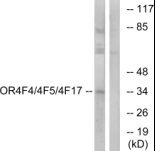 Western blot analysis of OR4F4 + OR4F5 + OR4F17 in extracts from MCF-7 cells using an OR4F4 + OR4F5 + OR4F17 polyclonal antibody (Product # PA5-39629).