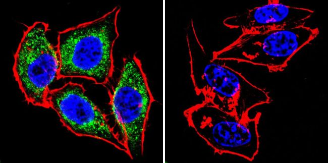 Immunofluorescent analysis of eNOS using eNOS Polyclonal Antibody (Product# PA3-031A ) shows staining in Hela Cells. eNOS (green), F-Actin staining with Phalloidin (red) and nuclei with DAPI (blue) is shown. Cells were grown on chamber slides and fixed with formaldehyde prior to staining. Cells were probed without (control) or with an antibody recognizing eNOS (Product# PA3-031A ) at a dilution of 1:200 over night at 4 ?C, washed with PBS and incubated with a DyLight-488 conjugated secondary antibody (Product# 35552 for GAR, Product# 35503 for GAM). Images were taken at 60X magnification.