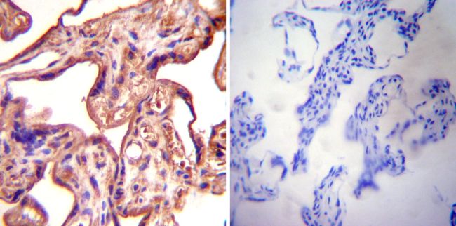 Immunohistochemistry was performed on normal deparaffinized Human placenta tissue tissues. To expose target proteins, heat induced antigen retrieval was performed using 10mM sodium citrate (pH6.0) buffer, microwaved for 8-15 minutes. Following antigen retrieval tissues were blocked in 3% BSA-PBS for 30 minutes at room temperature. Tissues were then probed at a dilution of 1:500 with a rabbit polyclonal antibody recognizing eNOS (PA3-031A) or without primary antibody (negative control) overnight at 4°C in a humidified chamber. Tissues were washed extensively with PBST and endogenous peroxidase activity was quenched with a peroxidase suppressor. Detection was performed using a biotin-conjugated secondary antibody and SA-HRP, followed by colorimetric detection using DAB. Tissues were counterstained with hematoxylin and prepped for mounting.
