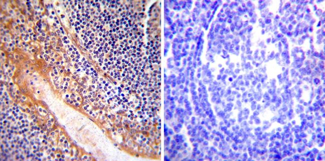 Immunohistochemistry was performed on normal deparaffinized Human tonsil tissue tissues. To expose target proteins, heat induced antigen retrieval was performed using 10mM sodium citrate (pH6.0) buffer, microwaved for 8-15 minutes. Following antigen retrieval tissues were blocked in 3% BSA-PBS for 30 minutes at room temperature. Tissues were then probed at a dilution of 1:200 with a rabbit polyclonal antibody recognizing eNOS (PA3-031A) or without primary antibody (negative control) overnight at 4°C in a humidified chamber. Tissues were washed extensively with PBST and endogenous peroxidase activity was quenched with a peroxidase suppressor. Detection was performed using a biotin-conjugated secondary antibody and SA-HRP, followed by colorimetric detection using DAB. Tissues were counterstained with hematoxylin and prepped for mounting.