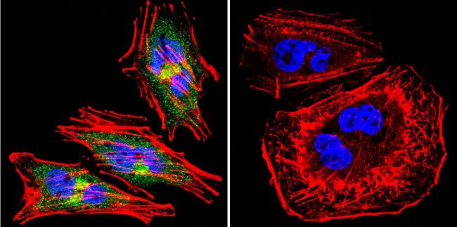 Immunofluorescent analysis of eNOS using eNOS Polyclonal Antibody (Product# PA3-031A ) shows staining in A2058 Cells. eNOS (green), F-Actin staining with Phalloidin (red) and nuclei with DAPI (blue) is shown. Cells were grown on chamber slides and fixed with formaldehyde prior to staining. Cells were probed without (control) or with an antibody recognizing eNOS (Product# PA3-031A ) at a dilution of 1:200 over night at 4 ?C, washed with PBS and incubated with a DyLight-488 conjugated secondary antibody (Product# 35552 for GAR, Product# 35503 for GAM). Images were taken at 60X magnification.