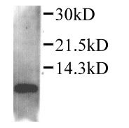 Western blot analysis of CCL4 in supernatant of RAW264.7 cells treated with LPS (15 hrs). Samples were probed with a CCL4 polyclonal antibody (Product # PA1-29036).