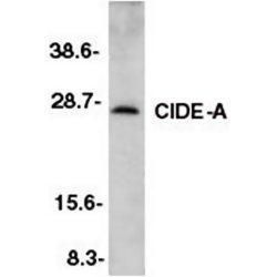 Western blot analysis of CIDE an In murine heart tissue lysate using a CIDE A polyclonal antibody (Product # PA1-30117).