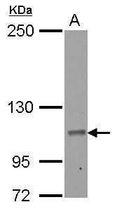 Western blot analysis of RIN2 using 30µg of HepG2 lysate. Samples were loaded onto a 5% SDS-PAGE gel and probed with a RIN2 polyclonal antibody (Product # PA5-30882) at a dilution of 1:1000.