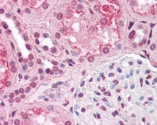<h6 id="pdp-product-imgtitle"> HIF1A Antibody (MA1-16504) </h6><p id="pdp-product-imgdesc"> Immunohistochemical staining of HIF1 alpha in human kidney. Renal tubular epithelium showed moderate membranous, cytoplasmic and nuclear staining, and glomeruli showed faint to moderate nuclear staining. </p>