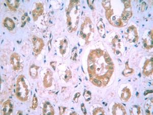 <h6 id="pdp-product-imgtitle"> HIF1A Antibody (MA1-16511) </h6><p id="pdp-product-imgdesc"> Immunohistochemical staining of HIF-1 alpha in human kidney using MA1-16511. </p>